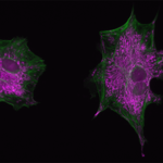 3T3 cells stained with MitoTracker Red and Alexa Fluor 488 phallodin. (CCAM)
