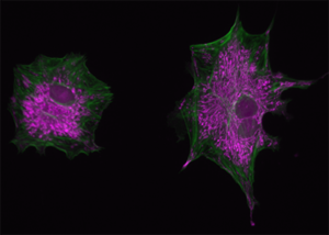 3T3 cells stained with MitoTracker Red and Alexa Fluor 488 phallodin. (CCAM)
