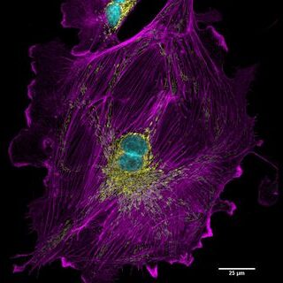 Advanced Light Microscopy